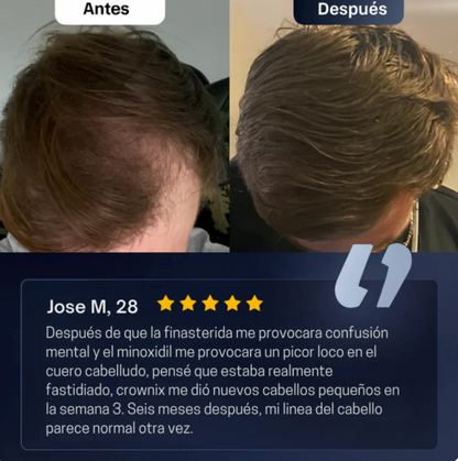 Roll-On de Crecimiento Capilar™